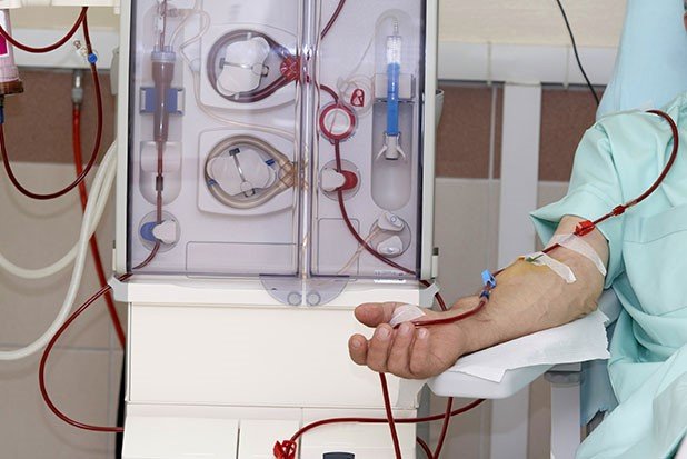 Dialysis Technology